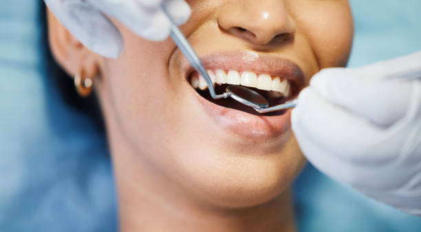 Best Emergency Root Canal Treatment in Commerce, GA